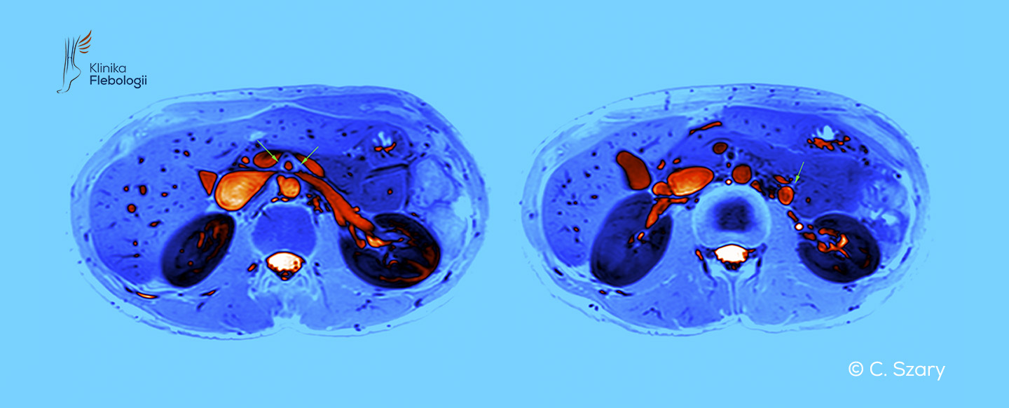 Zespół dziadka do orzechów wenografia