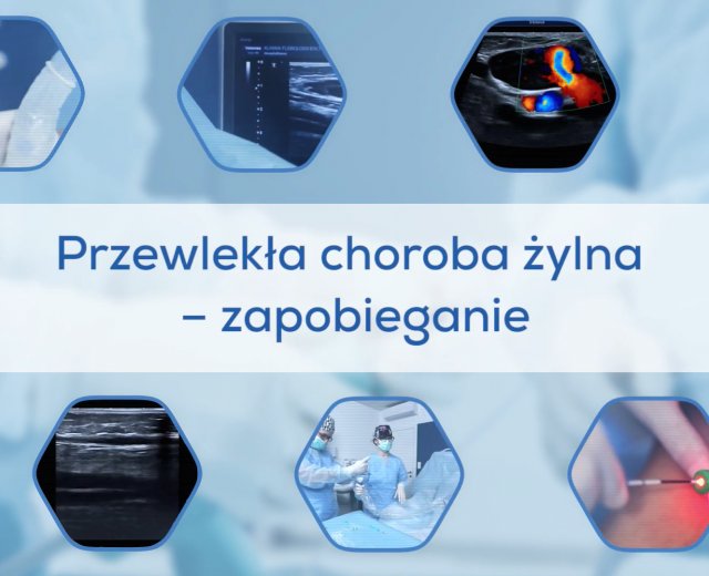Przewlekła choroba żylna - zapobieganie