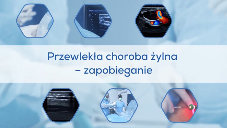 Przewlekła choroba żylna - zapobieganie