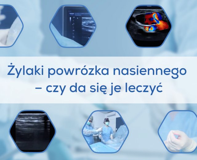 Żylaki powrózka nasiennego - czy da się je leczyć?