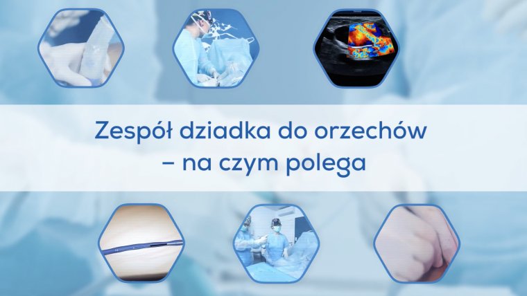 Zespół dziadka do orzechów - na czym polega?