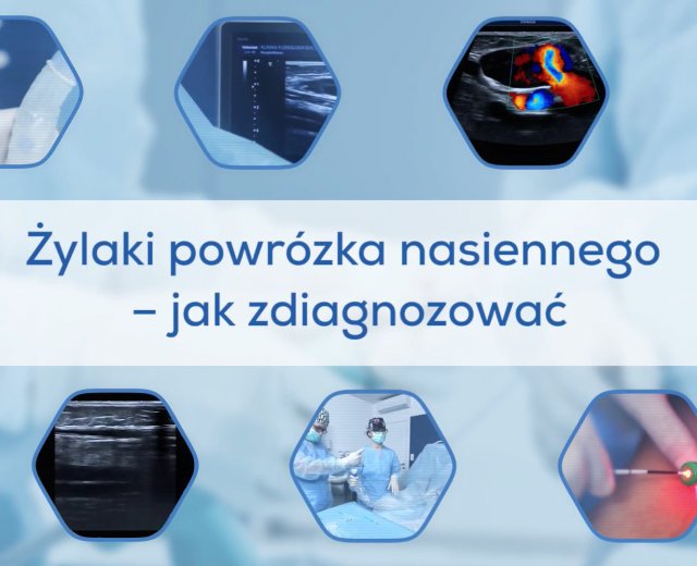 Żylaki powrózka nasiennego - jak zdiagnozować?