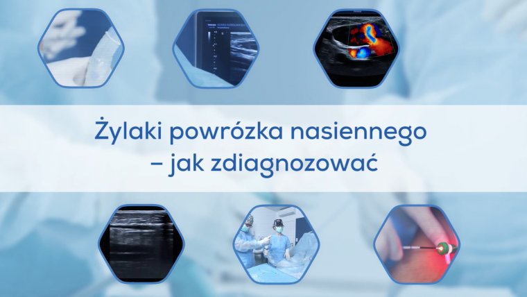 Żylaki powrózka nasiennego - jak zdiagnozować?