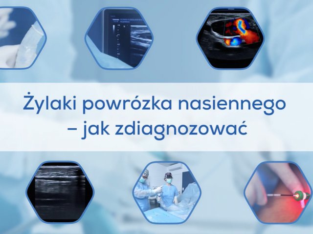 Żylaki powrózka nasiennego - jak zdiagnozować?