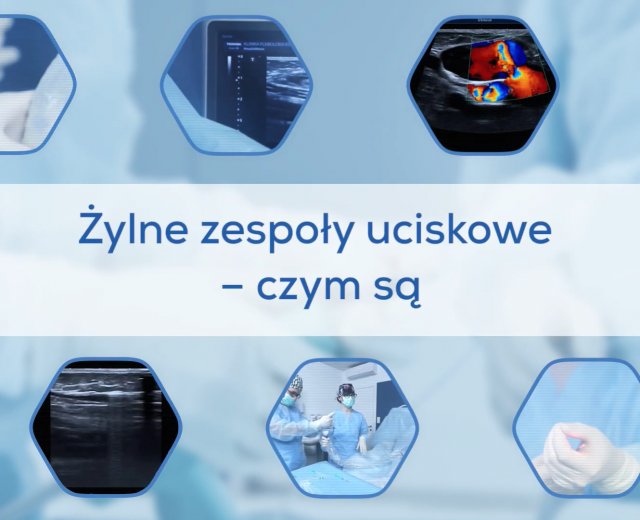 Żylne zespoły uciskowe - czym są?