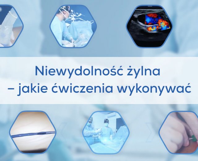 Niewydolność żylna - jakie ćwiczenia wykonywać?