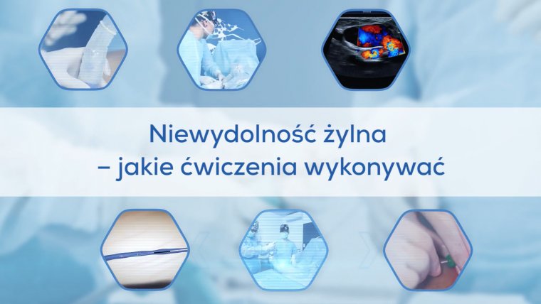 Niewydolność żylna - jakie ćwiczenia wykonywać?