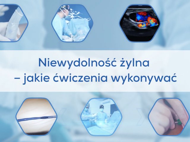 Niewydolność żylna - jakie ćwiczenia wykonywać?