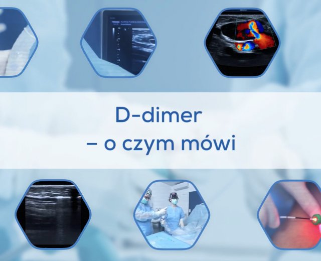 D-dimmer - o czym mówi?