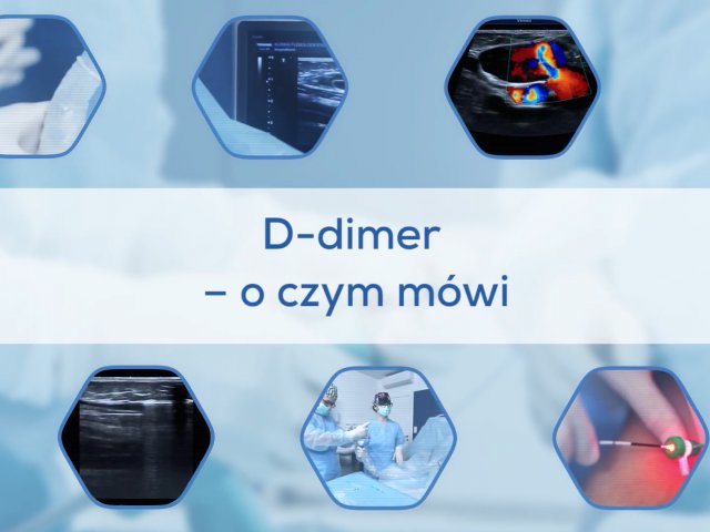 D-dimmer - o czym mówi?