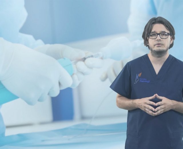 Klejenie żylaków - jakie są zalety tej metody