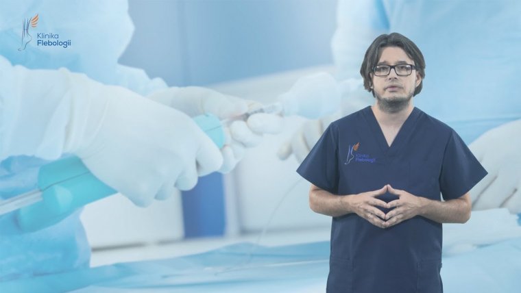 Klejenie żylaków - jakie są zalety tej metody