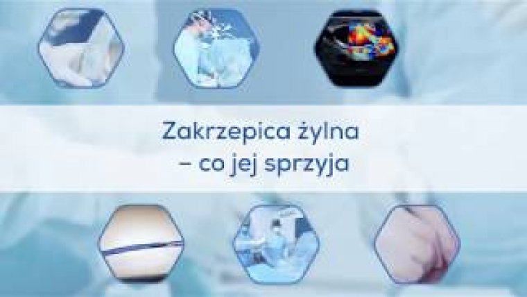 Zakrzepica żylna - co jej sprzyja?