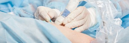 Zabiegi wewnątrzżylne