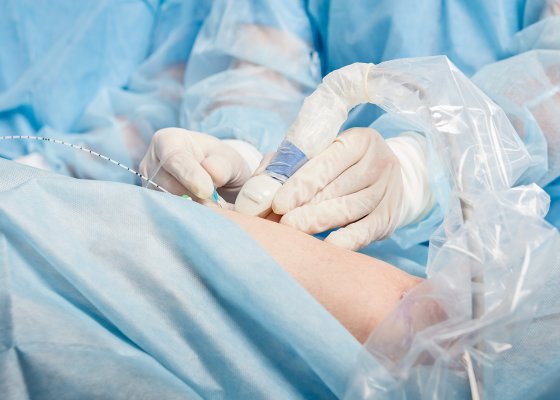 Zabiegi wewnątrzżylne